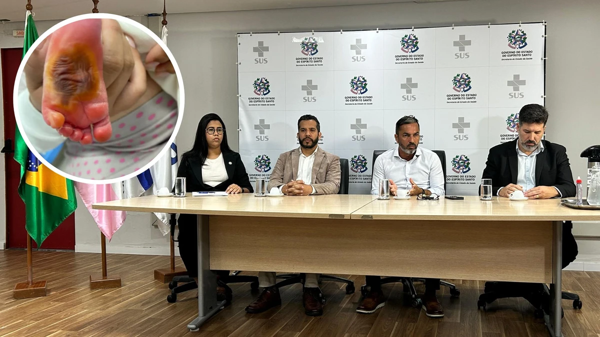 Coletiva de imprensa nesta segunda-feira (29) apresentou resultados de auditoria sobre bebê queimado em hospital da Serra