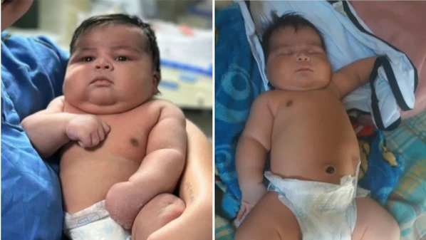 Alderico  teve o ombro deslocado no momento do nascimento e ficou cinco minutos sem respirar; a mãe do menino sofreu uma hemorragia durante o parto e precisou receber 55 pontos