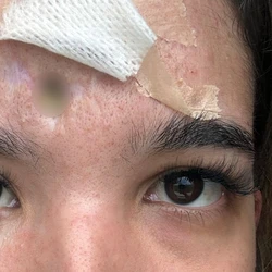 Michaella Zukoski foi atingida  por uma pedra (um PAVs, usado em calçamentos) enquanto estava no carro com o pai e o irmão, em julho de 2023