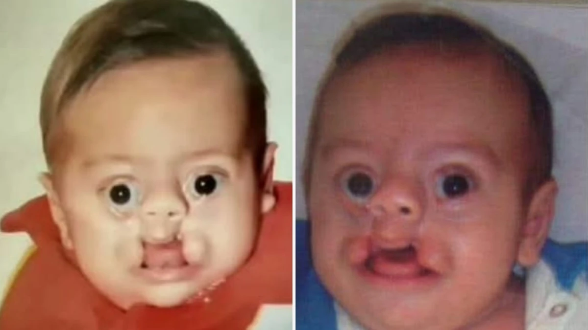 Iarley com 1 mês de vida 