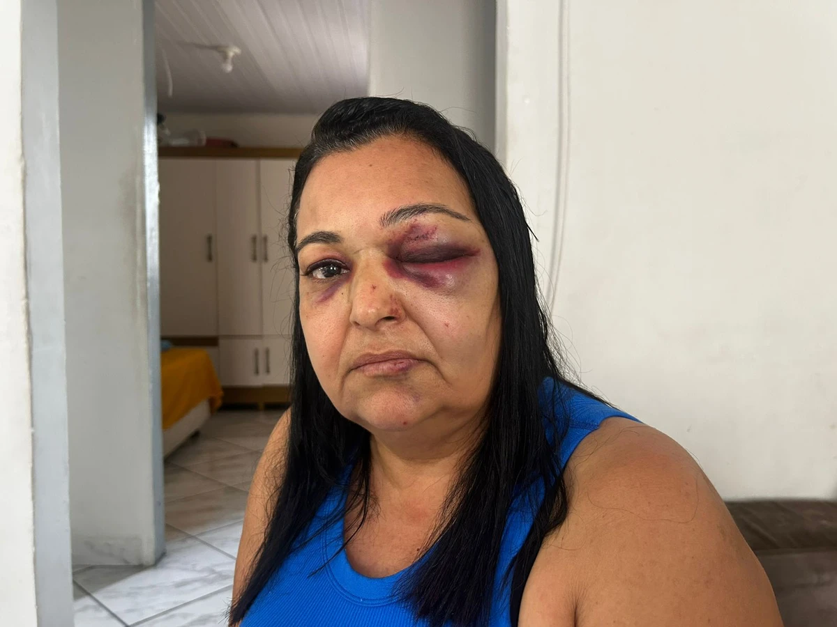 Motorista que atropelou mulher em faixa de pedestre aida não foi localizado