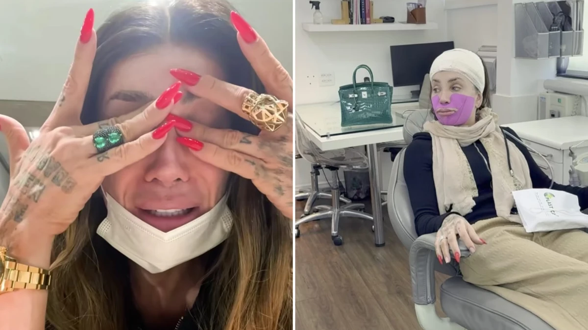 Rosto de Maya Massafera infecciona após cirurgia no maxilar: 'Não consigo parar de chorar'