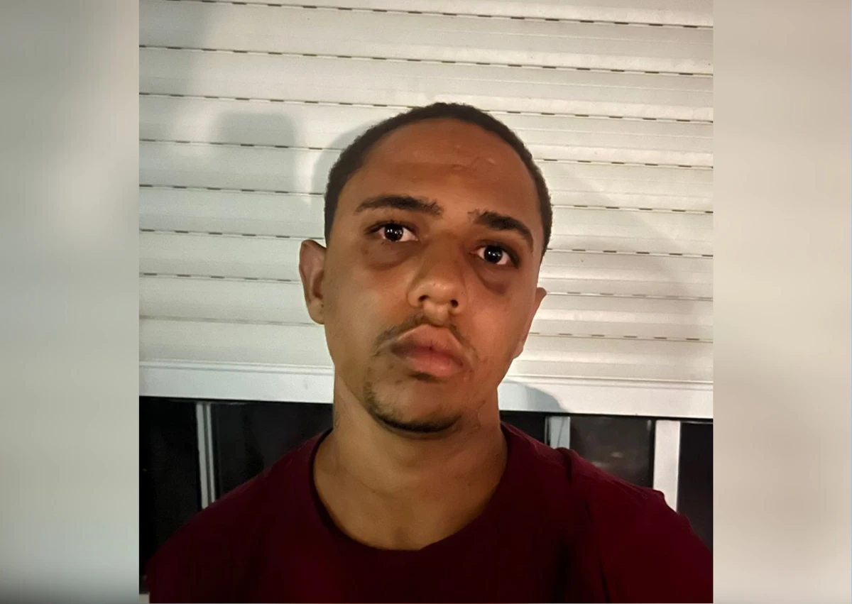 Luan Carlos Santos Rosa, vulgo Batata, de 19 anos, está foragido, suspeito de envolvimento em latrocínio