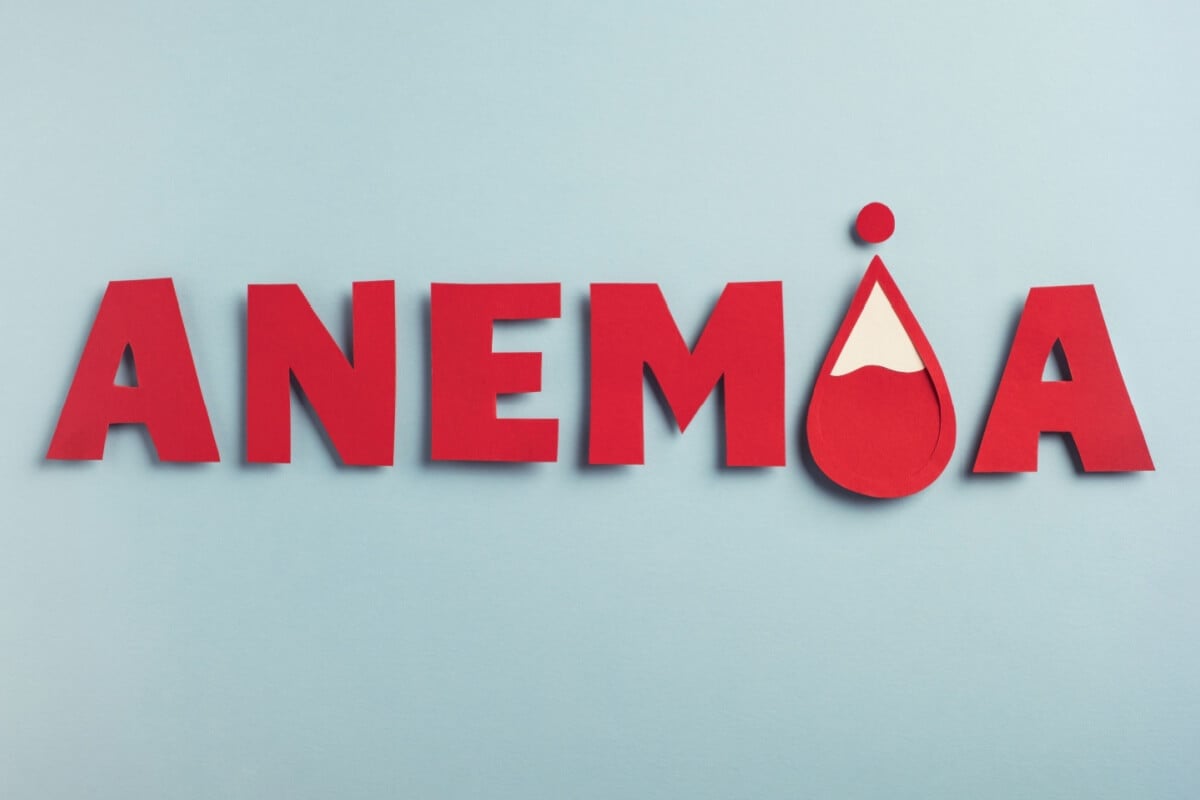 A anemia pode indicar doenças que exigem atenção médica (Imagem: Helena Nechaeva | Shutterstock)