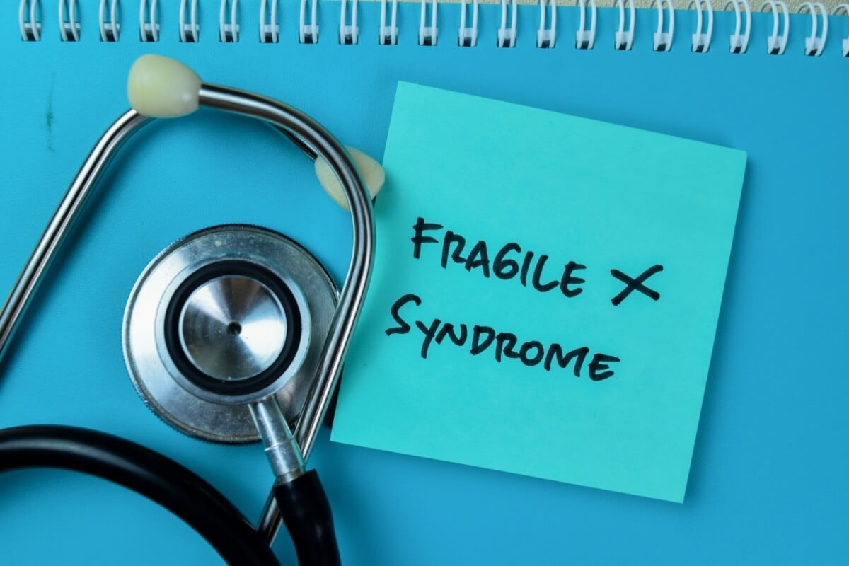 A Síndrome do X Frágil decorre de alterações no gene FMR1, localizado no cromossomo X (Imagem: bangoland | Shutterstock) 