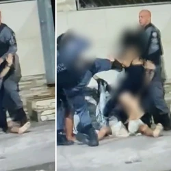 Segundo a mulher, ela tentava afastar o pai da sua filha dos policiais quando foi atingida; PM abriu procedimento para apurar a conduta