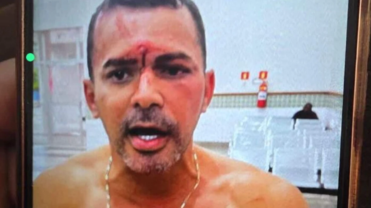 Estado em que ficou o vereador da Serra após se envolver em confusão