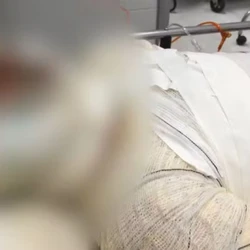 Adolescente de 13 anos foi socorrida por um motorista de aplicativo e está internada em Vitória, em estado grave