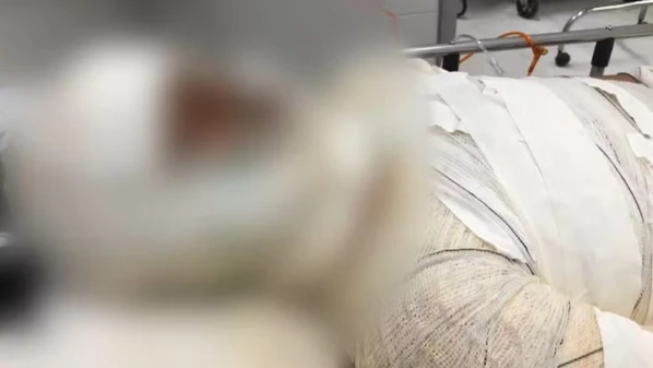 Adolescente de 13 anos foi socorrida por um motorista de aplicativo e está internada em Vitória, em estado grave