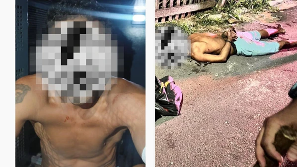 Homem de 33 anos foi baleado após invadir a casa de um policial penal e sacar uma faca durante abordagem, segundo a Polícia Penal