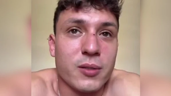 Segundo a vítima, o suspeito deu um soco no rosto dele já do lado de fora do evento, na madrugada do último domingo (21)