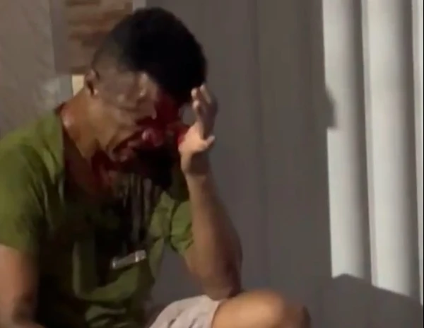  Charles Rosa Nascimento, 43 anos, é suspeito de matar gari a facada. Ele foi espancado por populares