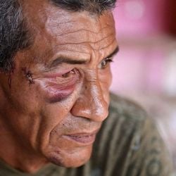 Um míssil atingiu um edifício no litoral da Venezuela durante o ataque dos EUA que resultou na captura de Nicolás Maduro, matando uma moradora idosa. Os sobreviventes contam o que aconteceu.