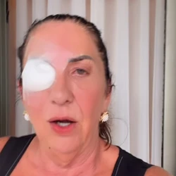 Margareth Serrão foi submetida a uma cirurgia no olho esquerdo para implante de uma lente intraocular, procedimento indicado tanto para correção de problemas de visão quanto para casos como catarata