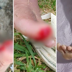 Especialista explica que comportamento territorial da espécie, aliado à degradação ambiental e ao período reprodutivo, ajudam a entender os registros frequentes neste verão