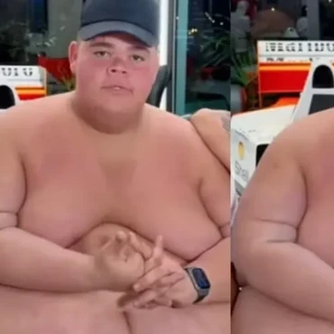 Imagem - Gordão da XJ abre o jogo sobre bariátrica e cirurgias após eliminar 130 kg