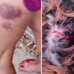 Vítima de 49 anos conseguiu fugir após agressões e ameaças de morte; suspeito foi contido por vizinhos no bairro Guaranhuns