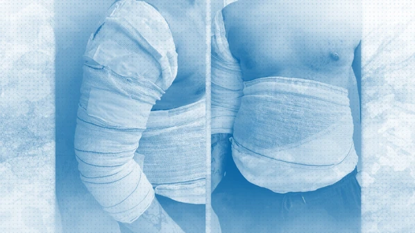 Lesões teriam ocorrido com suspeito sendo pressionado contra asfalto quente; juiz avalia que, se confirmada, a acusação "beira a prática da tortura"; veja vídeo