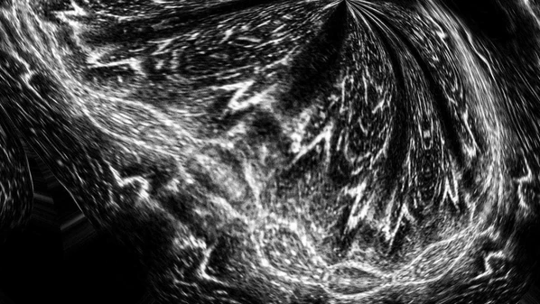 Ao conduzir o
equipamento sobre sua pele, Mazzoni produz autorretratos sonoros, visualidades que surgem da
interação entre corpo, imagem, som e gesto