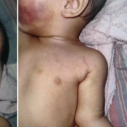 Menina de 7 meses estava com lesões no rosto; vizinhos relataram ouvir choro intenso vindo da casa