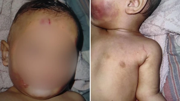 Menina de 7 meses estava com lesões no rosto; vizinhos relataram ouvir choro intenso vindo da casa