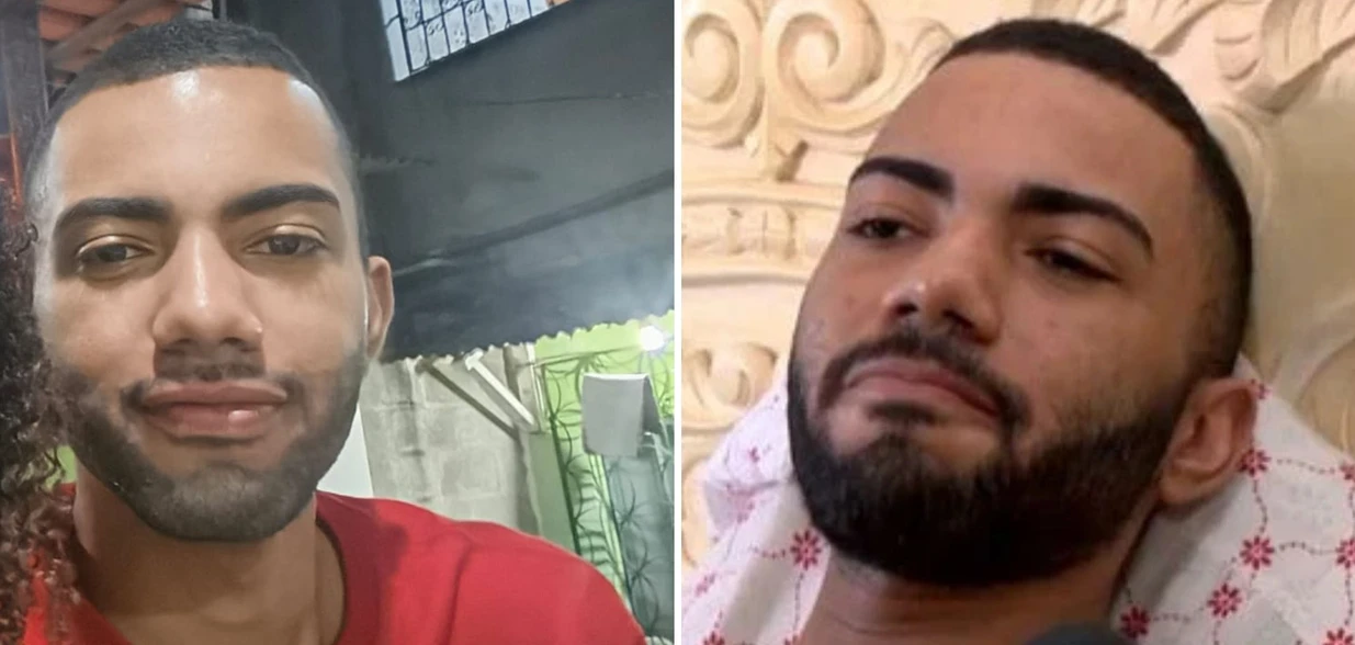 Um ano e dois meses depois do acidente Paulo César Santana de Oliveira já não trabalha como motoboy, mas ainda convive com dores constantes na perna