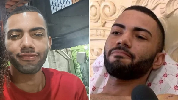 Um ano e dois meses depois do acidente Paulo César Santana de Oliveira já não trabalha como motoboy, mas ainda convive com dores constantes na perna