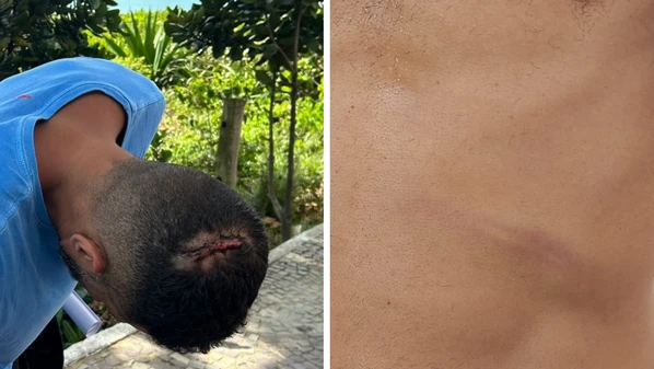 Mineiro de 46 anos afirma que sofreu agressões de sete funcionários após contestar cobrança de R$ 215 por cinco cervejas; caso é investigado pela polícia