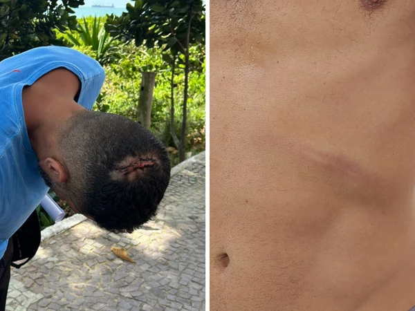 Júlio César da Costa Simim, de 46 anos, afirma ter sido agredido por cerca de sete funcionários após contestar cobrança de R$ 215 por cinco cervejas, em Vila Velha