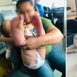 Nywram Maicon Chaves Barbieri, de um ano e nove meses, está internado no Hospital Infantil, em Vitória, e apresenta queimaduras de segundo grau nos pezinhos. Polícia já investiga o caso