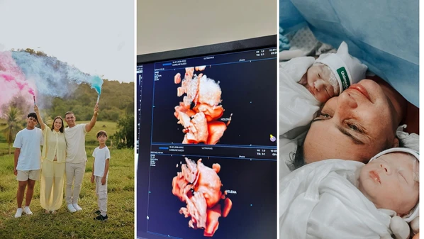 Condição em que a criança nasce envolta pela bolsa amniótica é considerada rara no mundo da obstetrícia, segundo especialistas