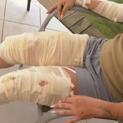 Vítima estava com um amigo em uma festa de Carnaval e notou a presença do ex. Ao saírem do local, a moto deles foi perseguida e atingida pelo carro dirigido pelo suspeito