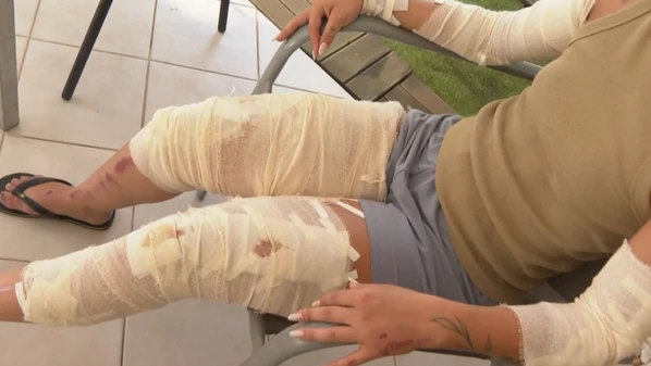 Vítima estava com um amigo em uma festa de Carnaval e notou a presença do ex. Ao saírem do local, a moto deles foi perseguida e atingida pelo carro dirigido pelo suspeito; polícia trata o caso como tentativa de homicídio