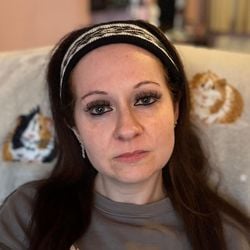 Emma Dyer afirma que desmaiou no chão do banheiro e começou a vomitar sangue depois de comprar injeções online.