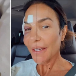 A diarreia é caracterizada pelo aumento do número de evacuações com fezes líquidas ou amolecidas