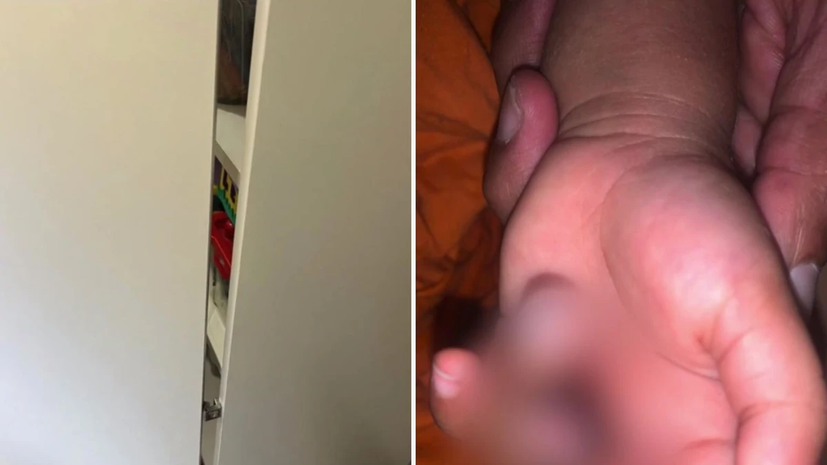 A direção da creche informou que o menino teria prendido o dedo em uma dobradiça