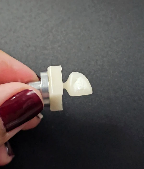 Prótese feita na impressora 3D do Laboratório Digital do Sesc