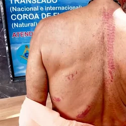 Segundo a vítima, dois criminosos armados e encapuzados invadiram a casa na Praia de Carapebus. Suspeitos, que não foram presos, roubaram 6,5 mil dólares e um celular.