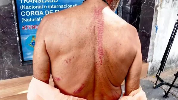 Segundo a vítima, dois criminosos armados e encapuzados invadiram a casa na Praia de Carapebus. Suspeitos, que não foram presos, roubaram 6,5 mil dólares e um celular.