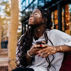 Condição comum que provoca manchas brancas na pele ainda gera dúvidas e preconceitos