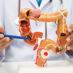 Especialista fala sobre prevenção, fatores de risco e esclarece mitos e verdades sobre a doença